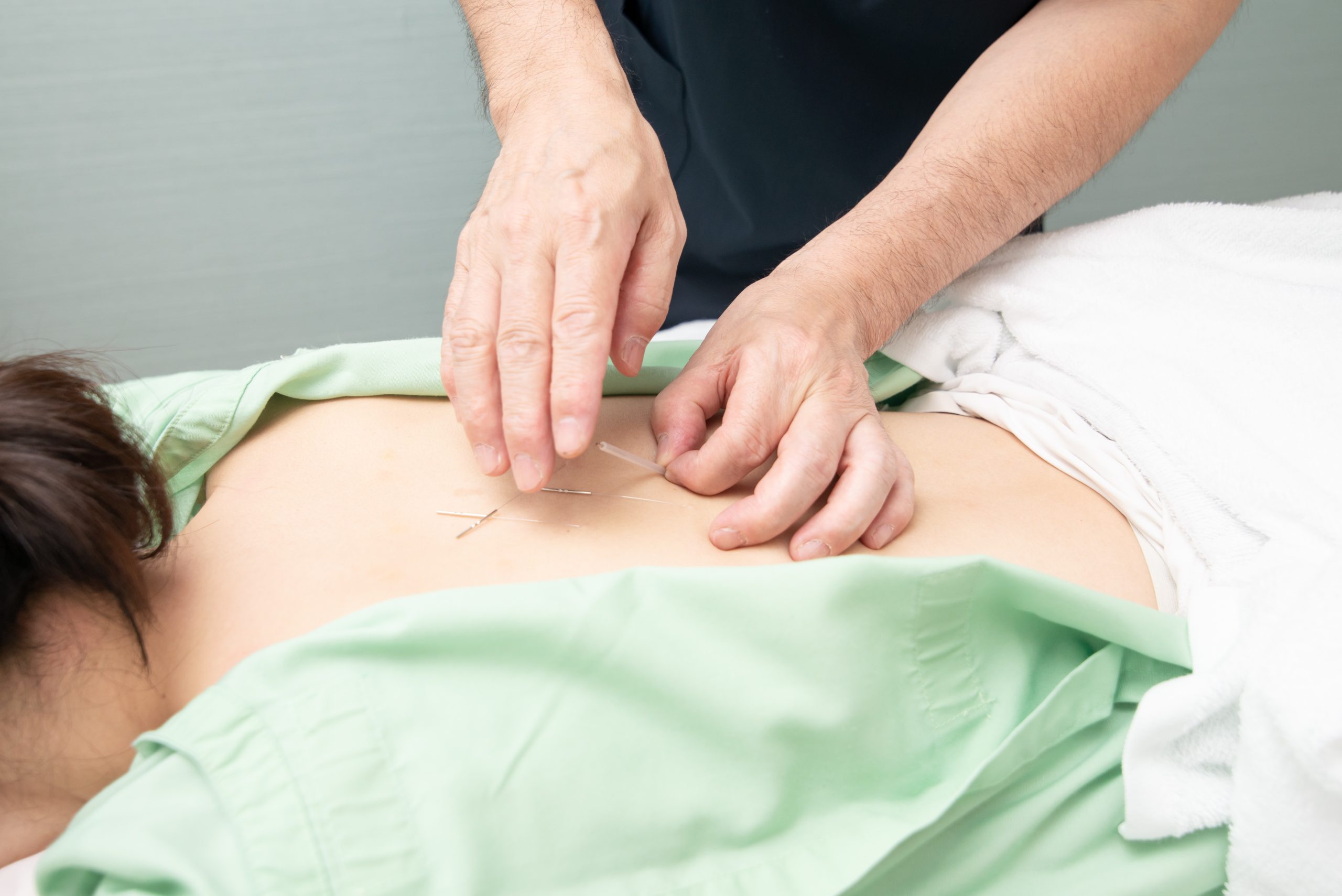 東洋医学による婦人科系施術風景